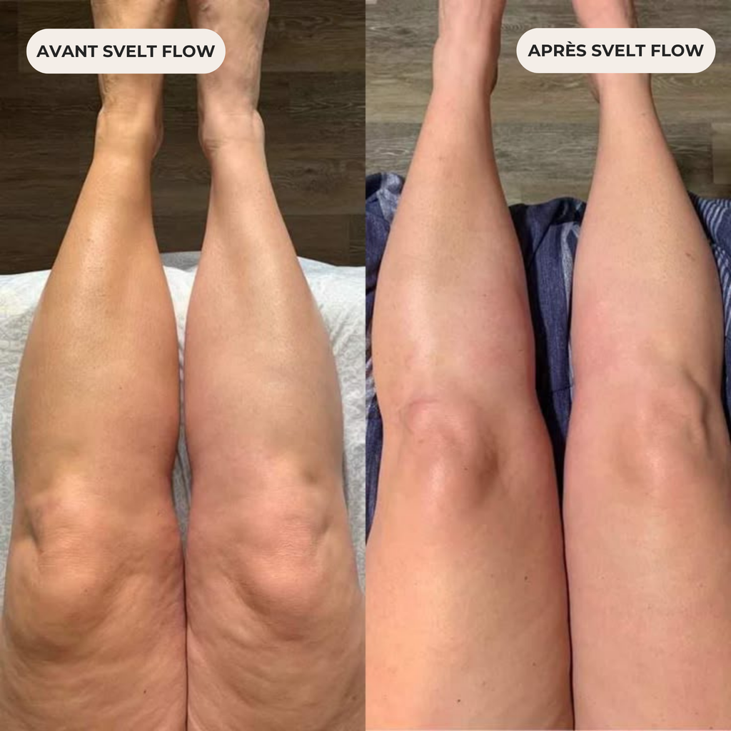 Révélez une peau visiblement plus lisse grâce à notre masseur corporel anti-cellulite SVELT Flow.